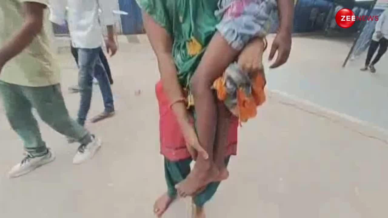 VIDEO: मासूम बच्ची को डंस गया जानलेवा सांप, दोनों को अस्पताल ले पहुंचे परिजन; मच गई अफरा-तफरी