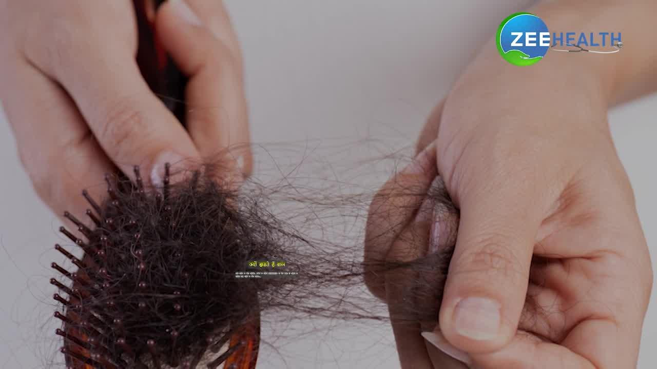 ये हैं वो 5 कारण जिनकी वजह से झड़ने लगते हैं बाल, देखिए VIDEO